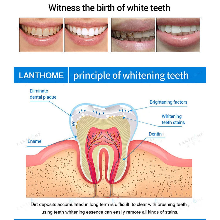 TeethWhip™ - Tooth Whitening Essence (50% OFF)