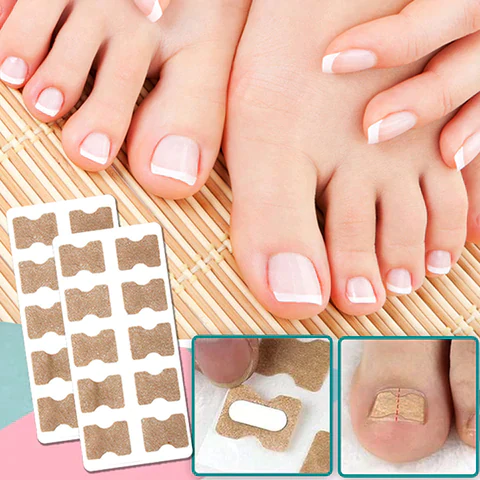 NailFixer™ - Nail Correction Sticker Strips (50% OFF)