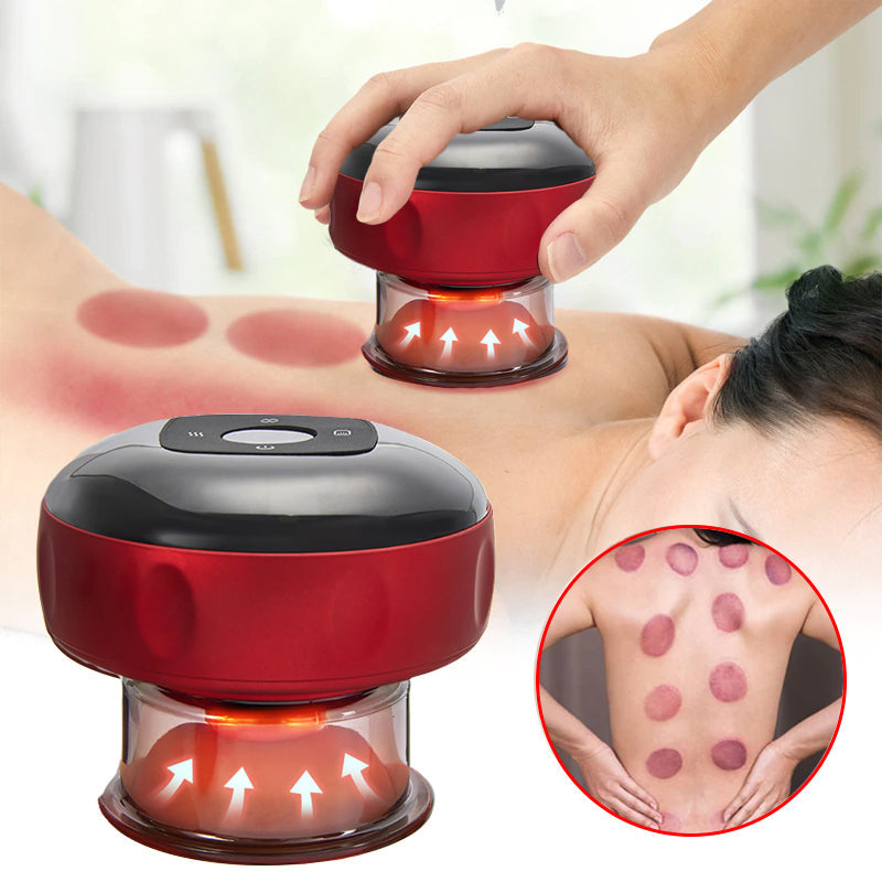 Cuppish™ Smart Cupping Massage Device