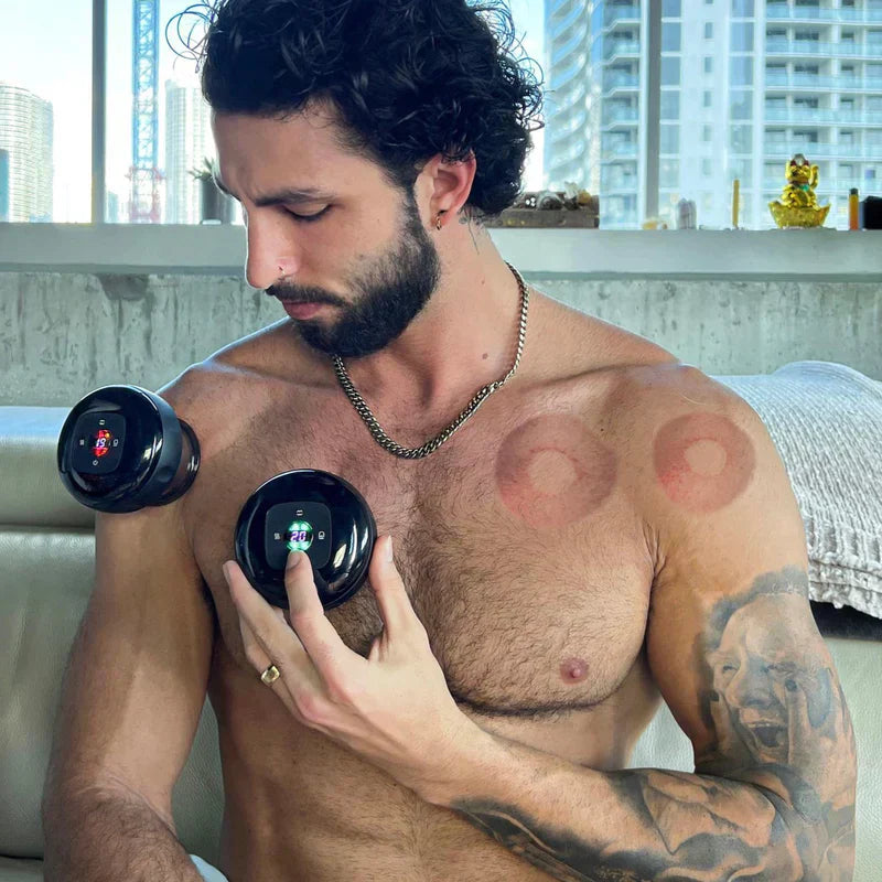 Cuppish™ Smart Cupping Massage Device