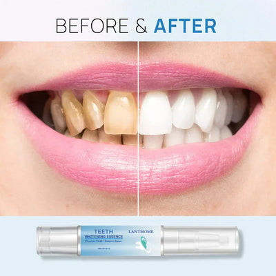 TeethWhip™ - Tooth Whitening Essence (50% OFF)