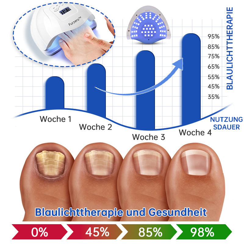 NailCure™ - Nail Fungus Laser Treatment Solution (50% OFF)