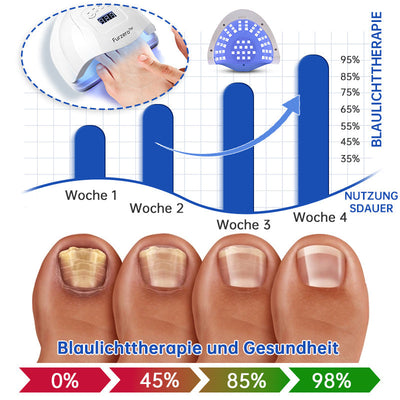 NailCure™ - Nail Fungus Laser Treatment Solution (50% OFF)