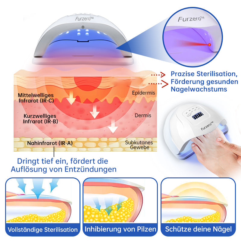 NailCure™ - Nail Fungus Laser Treatment Solution (50% OFF)