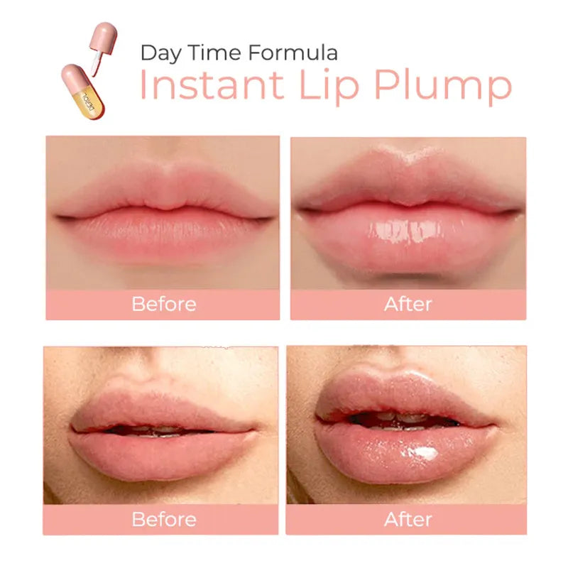 Derol™ - Lip Plumper Kit (50% OFF)