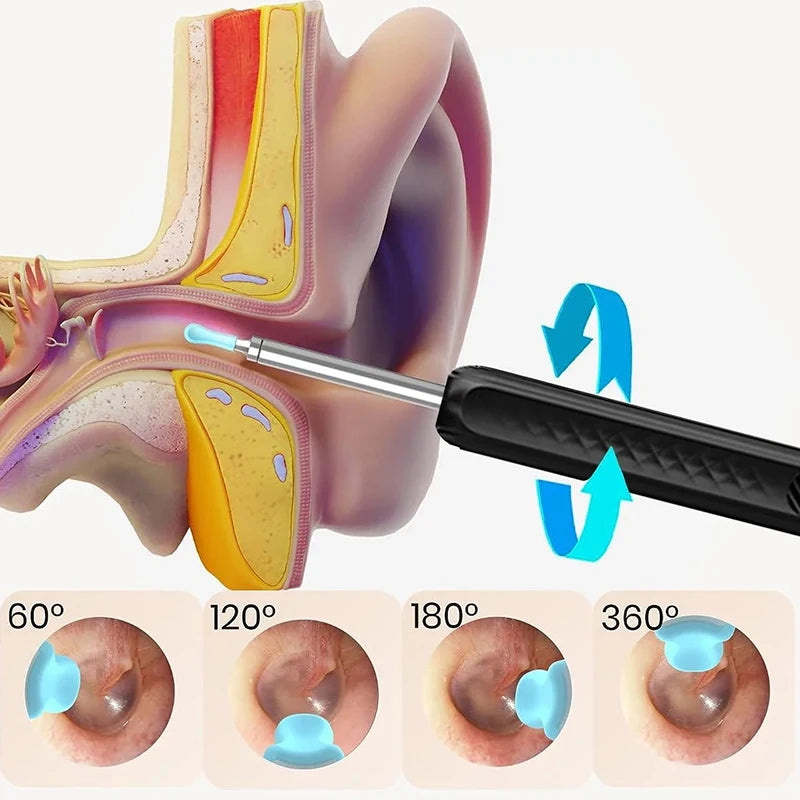 EarScan™ - Wireless Borescope for Health Care & Ear Cleaning