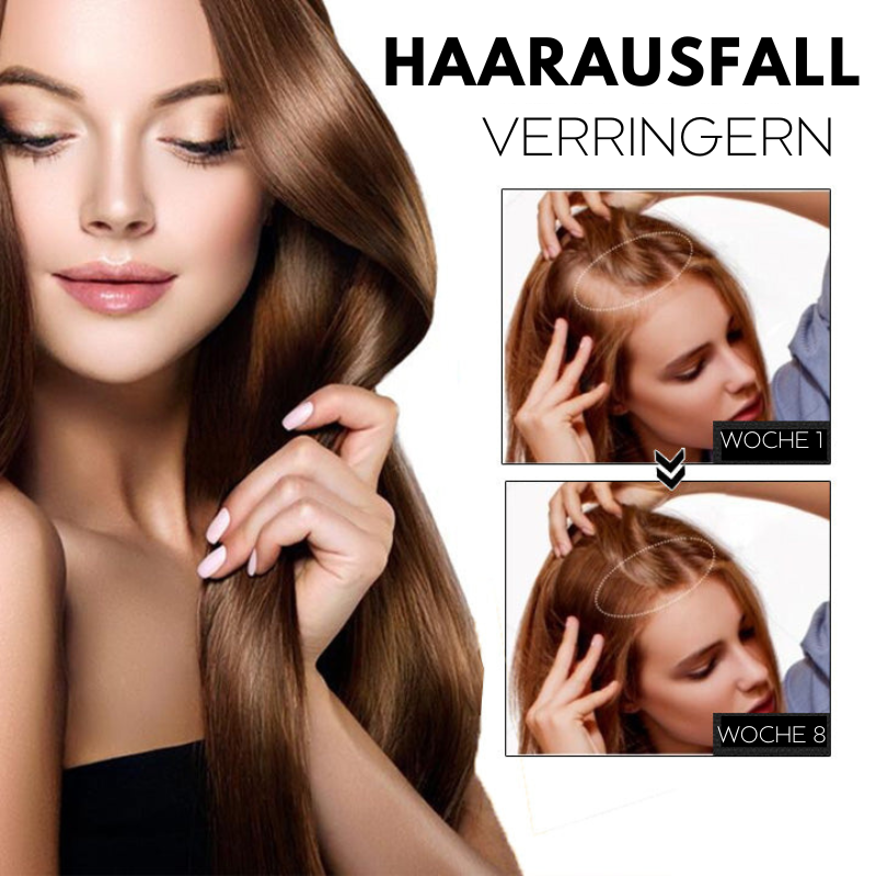 1+1 FREE | HairRegrow™ | Hair Growth Spray