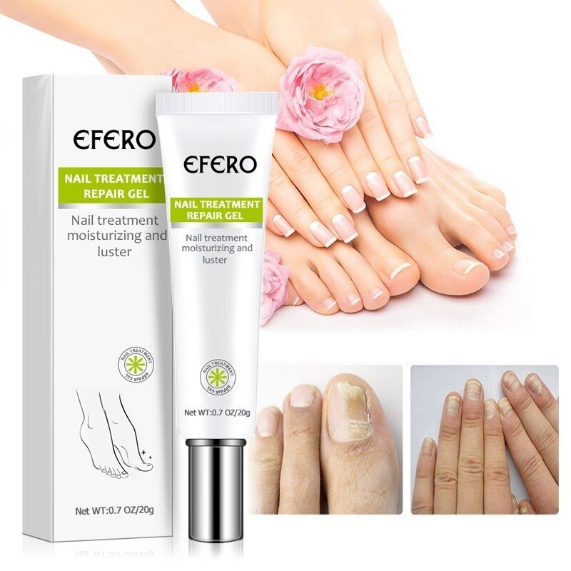 Nail Repair | Fast and Effective Results! 1+1 FREE!