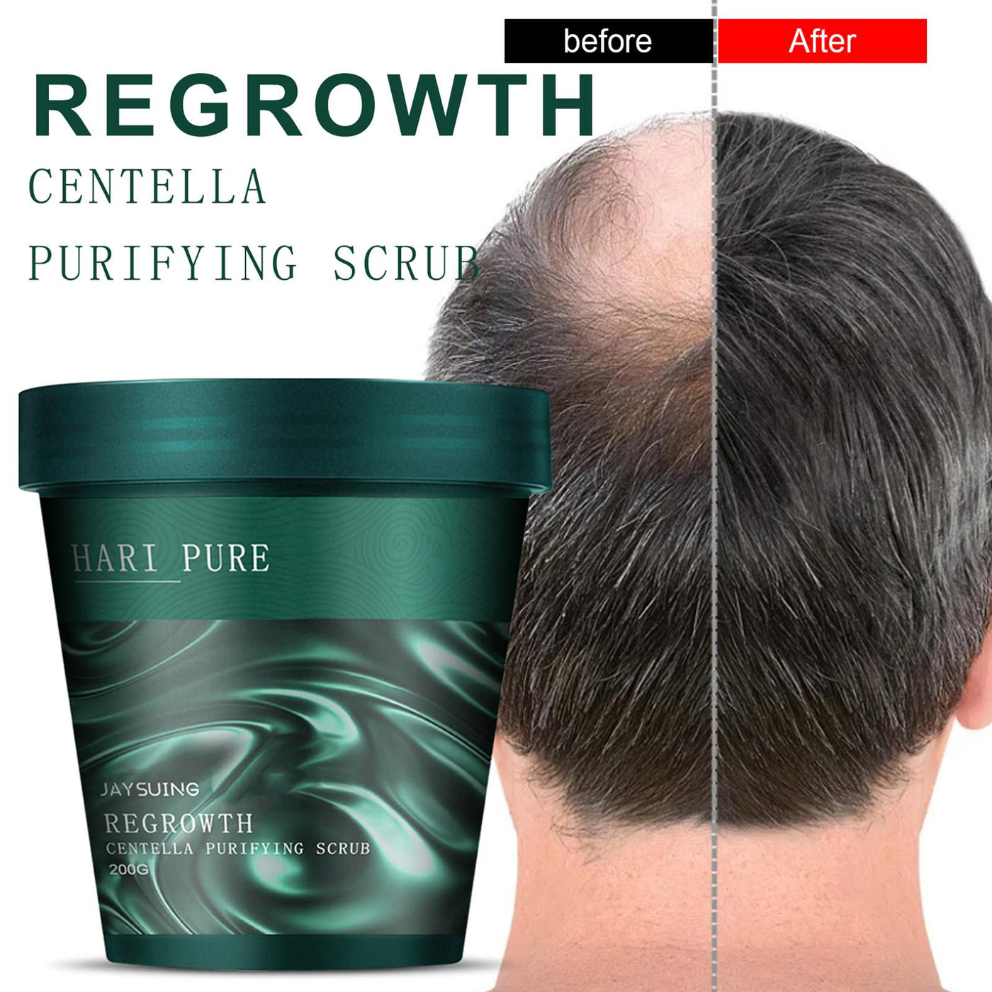 HairPure™ ReGrowth Centella Purifying Scrub 1+1 FREE